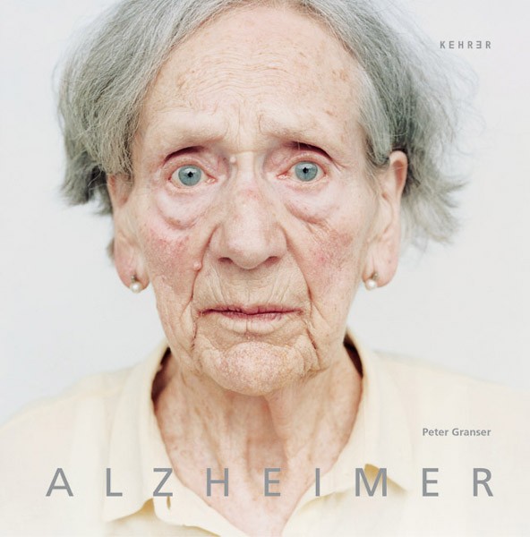 Peter Granser Alzheimer 